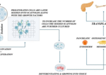 Stem Cell Treatment in London