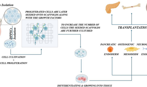 Stem Cell Treatment in London
